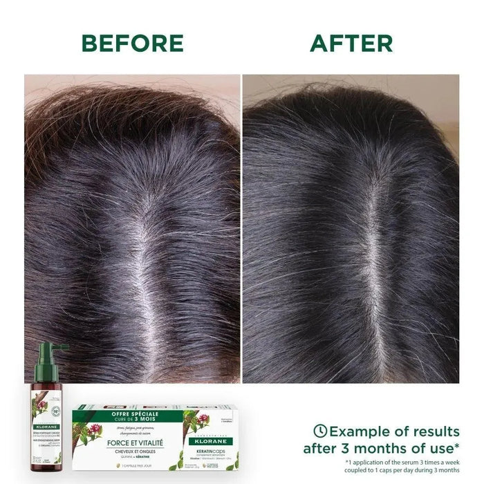 Klorane KeratinCaps (3 x 30 capsules) - Hairgivers