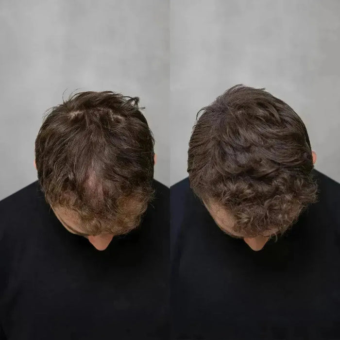 Keratain pomade + Keratain hair fibers – Light brown (25 gr) - Hairgivers