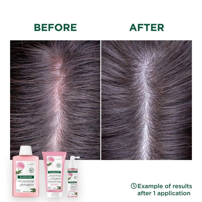 Klorane treatment for sensitive scalp - Hairgivers