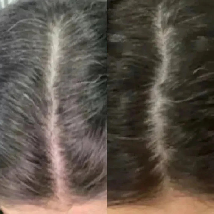 Neofollics anti-grey hair tablets - Hairgivers