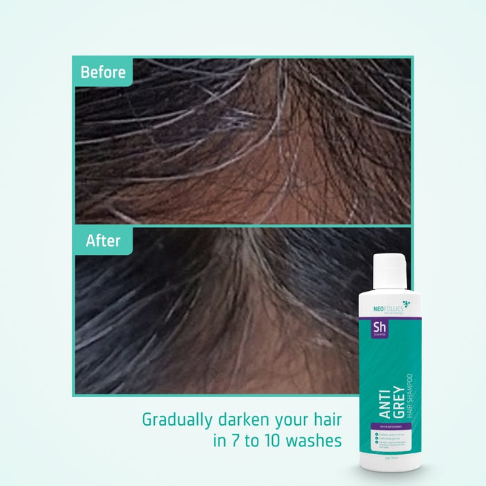Neofollics anti-grey shampoo