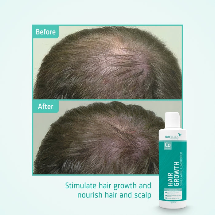 Neofollics conditioner (250 ml)