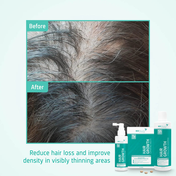 Neofollics Shampoo + Serum + Tablets