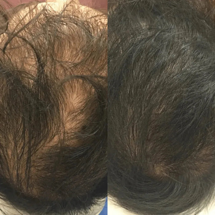 Revita hair growth shampoo (205 ml) - Hairgivers
