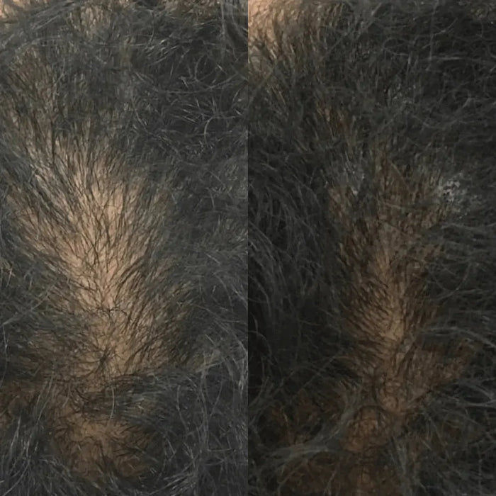 Revita tablets for hair growth (3 months) - Hairgivers